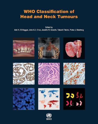 WHO classification of head and neck tumours - World Health Organization Classification of Tumours (Paperback)