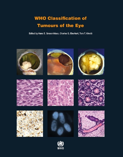 WHO classification of tumours of the eye - World Health Organization Classification of Tumours Vol. 12 (Paperback)