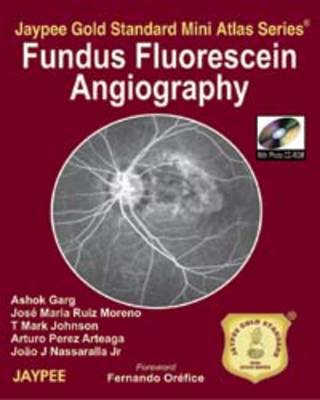 Jaypee Gold Standard Mini Atlas Series: Fundus Fluorescein Angiography - Jaypee Gold Standard Mini Atlas Series