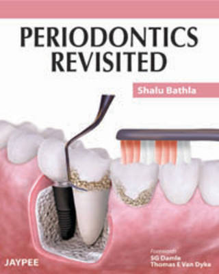 Periodontics Revisited (Paperback)
