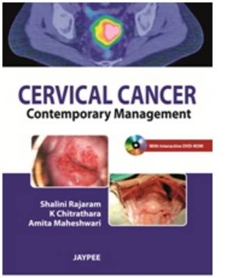 Cervical Cancer: Contemporary Management (Paperback)