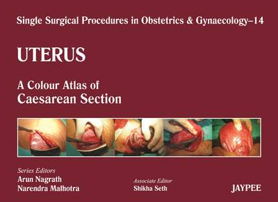 Single Surgical Procedures in Obstetrics and Gynaecology - Volume 14 - Uterus: A Colour Atlas of Caesarean Section - Single Surgical Procedures (Hardback)