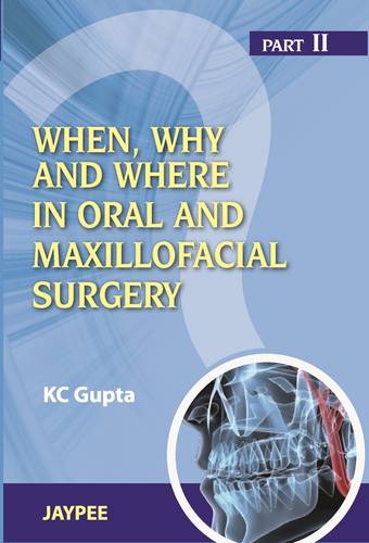 When, Why And Where In Oral And Maxillofacial Surgery: Prep Manual For Undergraduates And Postgraduates Part II (Paperback)