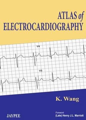 Atlas of Electrocardiography (Hardback)