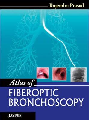 Atlas of Fiberoptic Bronchoscopy (Hardback)