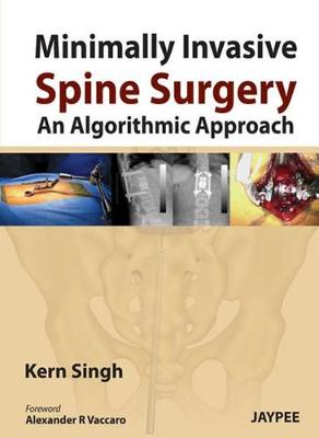 Minimally Invasive Spine Surgery: An Algorithmic Approach (Hardback)