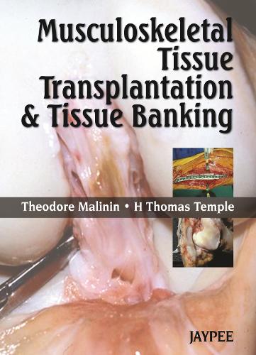Musculoskeletal Tissue Transplantation and Tissue Banking (Hardback)