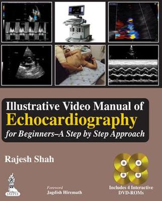 Illustrative Video Manual of Echocardiography for Beginners - A Step by Step Approach (Hardback)