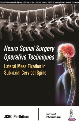 Neuro Spinal Surgery Operative Techniques: Lateral Mass Fixation in Sub-axial Cervical Spine (Paperback)