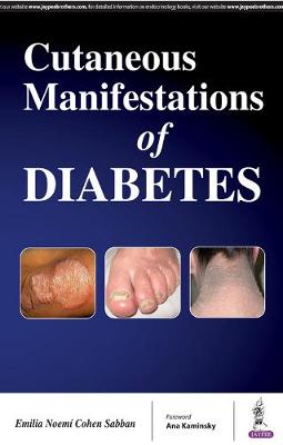 Cutaneous Manifestations of Diabetes (Paperback)