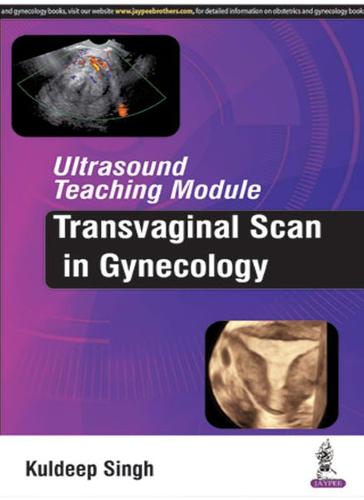 Ultrasound Teaching Module: Transvaginal Scan in Gynecology (Paperback)