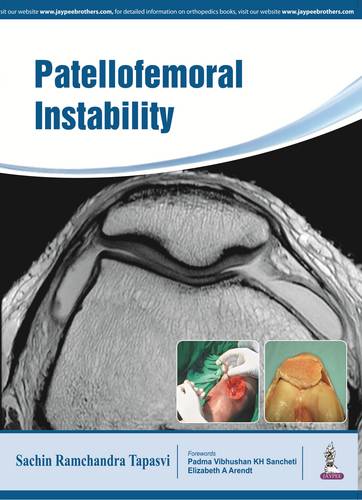 Patellofemoral Instability (Paperback)