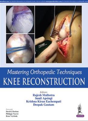 Mastering Orthopedic Techniques: Knee Reconstruction (Hardback)