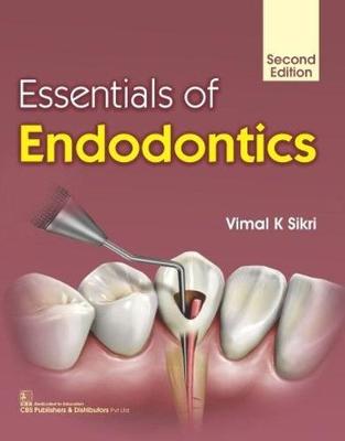 Essentials of Endodontics (Paperback)