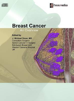 Breast Cancer: An Overview (CD-ROM)