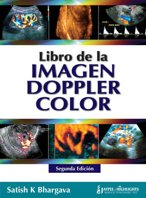 Libro de la Imagen Doppler Color (Hardback)