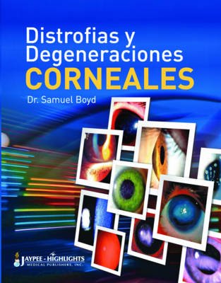 Distrofias y Degeneraciones Corneales (Paperback)