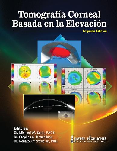Tomografia Corneal Basada en la Elevacion (Hardback)