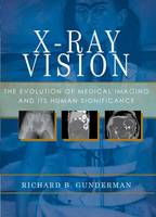X-Ray Vision: The Evolution of Medical Imaging and Its Human Significance (Paperback)