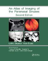 Atlas of Imaging of the Paranasal Sinuses, Second Edition (Paperback)