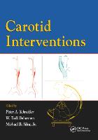 Carotid Interventions (Paperback)