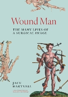 Wound Man: The Many Lives of a Surgical Image (Hardback)