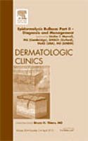 Epidermolysis Bullosa: Part II - Diagnosis and Management, An Issue of Dermatologic Clinics Volume 28-2 - The Clinics: Dermatology (Hardback)
