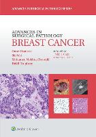 Advances in Surgical Pathology: Breast Cancer - Advances in Surgical Pathology (Hardback)