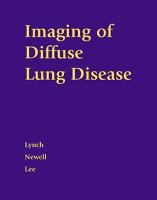IMAGING OF DIFFUSE LUNG DISEASE (Hardback)