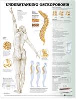 Understanding Osteoporosis Anatomical Chart (Wallchart)