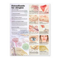 Understanding Allergies Anatomical Chart in Spanish (Entendiendo Las Alergias) (Wallchart)