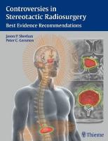 Controversies in Stereotactic Radiosurgery