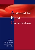 Manual For Blood Conservation (Paperback)