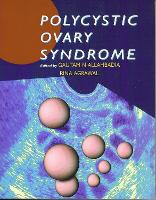 Polycystic Ovary Syndrome (Paperback)