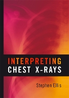 Interpreting Chest X-Rays (Paperback)