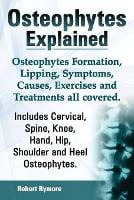 Osteophytes Explained. Osteophytes Formation, Lipping, Symptoms, Causes, Exercises and Treatments All Covered. Includes Cervical, Spine, Knee, Hand, Hip, Shoulder and Heel Osteophytes. (Paperback)