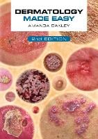 Dermatology Made Easy, second edition
