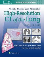 Webb, Muller and Naidich's High-Resolution CT of the Lung (Hardback)