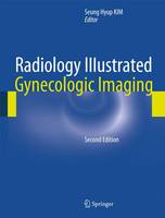 Radiology Illustrated: Gynecologic Imaging - Radiology Illustrated (Hardback)