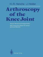 Arthroscopy of the Knee Joint: Diagnosis and Operation Techniques (Paperback)