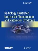 Radiology Illustrated: Nutcracker Phenomenon and Nutcracker Syndrome - Radiology Illustrated (Hardback)