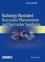 Radiology Illustrated: Nutcracker Phenomenon and Nutcracker Syndrome - Radiology Illustrated (Paperback)