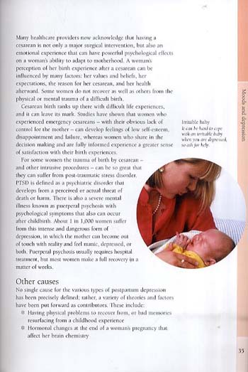 Caesarean Recovery (Paperback)